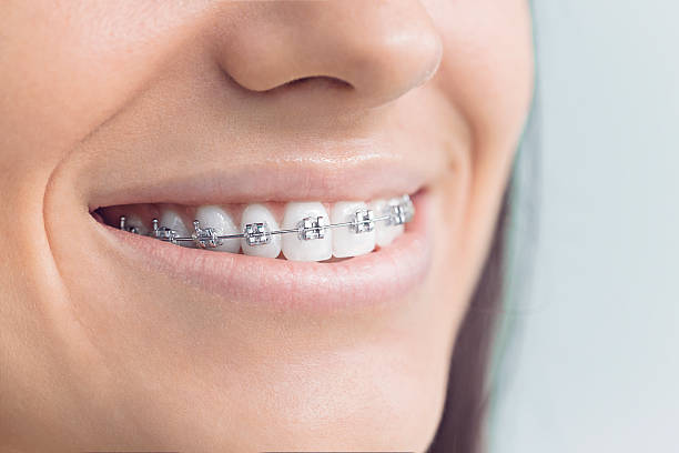 Full Mouth Reconstruction in Brooklet, GA